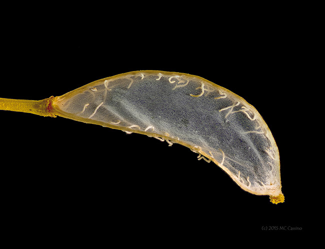 A stacked macro image of a tiny seed pod.